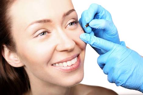 Odstranění milií sterilní jehlou (5 a více)